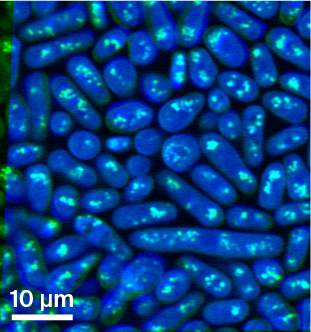 Composite image of stimulated Raman scattering data where different molecular bonds are represented by different colors.